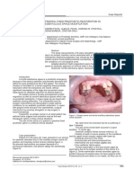 Frontal Fixed Prosthetic Restoration in Edentulous Space Modification