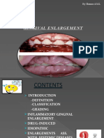 Gingival Enlargement: by Hamza AJAL