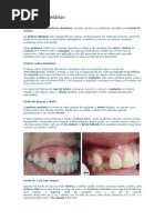 proteses_dentarias