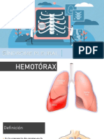 Sindrome Pleural