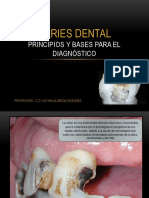 Principios y Bases para El Diagnóstico de Caries