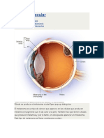 Melanoma Ocular