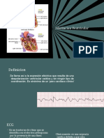 taquicardiaventricular-161004062252 (1)-62-69