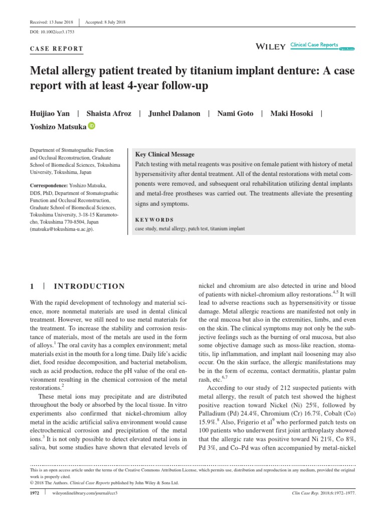 Metal Allergy PDF Allergy Dental Implant