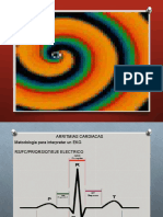 Arritmias Cardiacas