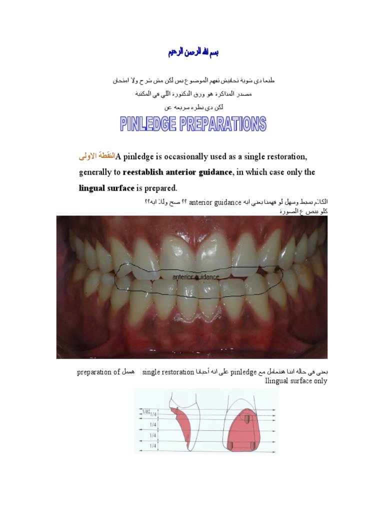 A Pinledge Is Occasionally Used As A Single Restoration, Generally To