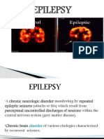 Epilepsy