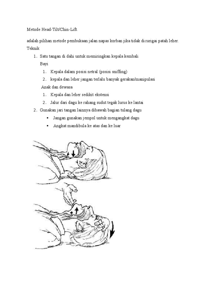 Metode Head TiltChin Lift Dan Jaw Thrust