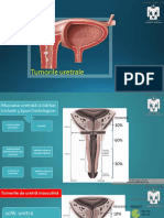 9 tumorile uretrale