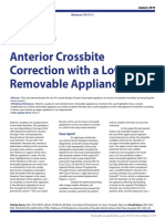 Anterior Crossbite With Removable Appliance