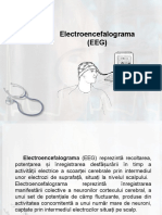 Electroencefalograma (EEG).pptx