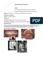 Implante Dental en 21 Luis Guillermo Tabares Con Reg e Injerto de TC Subep