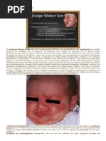 ASML - Products - HMI Escan Series | PDF