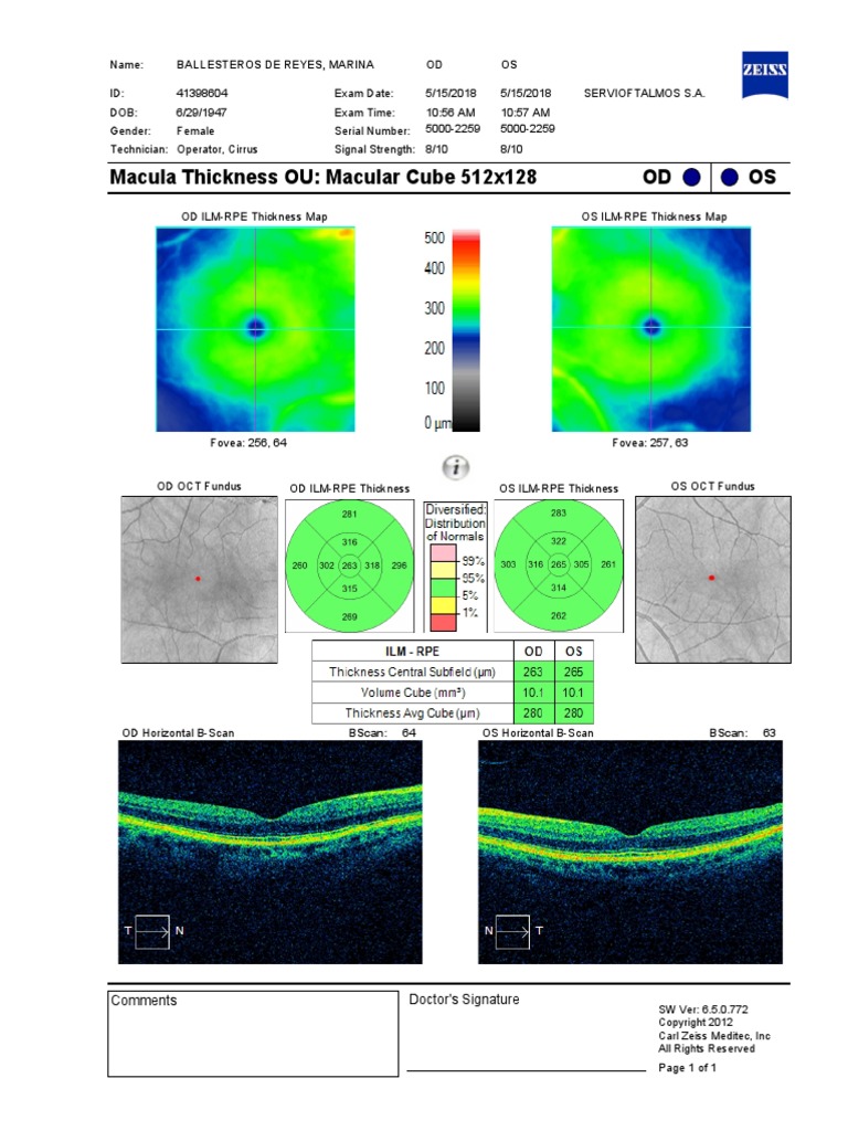 OS OD Macula Thickness OU: Macular Cube 512x128 | PDF