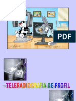 Teleradiografia