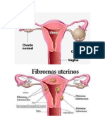 alteraciones ginecologicas.docx