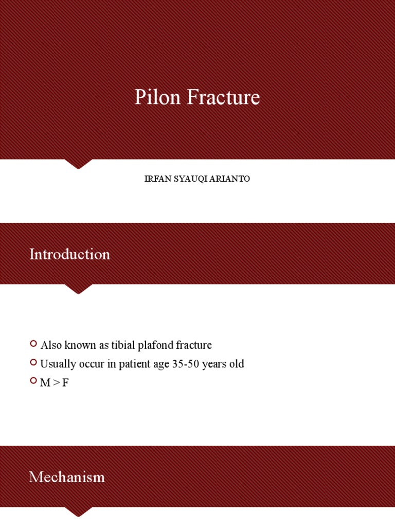 Understanding Pilon Fractures: Causes & Treatment | PDF