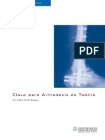 CLAVO ARTRODESIS TOBILLO.pdf