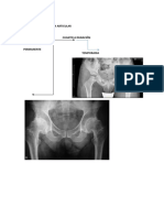 GENERALIDADES SISTEMA ARTICULAR