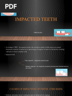 Impacted Teeth