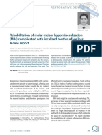 Rehabilitation of Molar-Incisor Hypomineralization (MIH) Complicated With Localized Tooth Surface Loss 2014