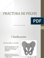 Fractura de Pelvis
