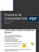 Fracturas de Extremidad Inferior