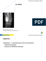 FX Femur Distal