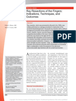 Ray Resections of The Fingers: Indications, Techniques, and Outcomes