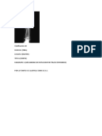 Ejemplo Clasificacion Ao Fracturas