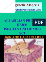 Androgenic Alopecia For Tehran