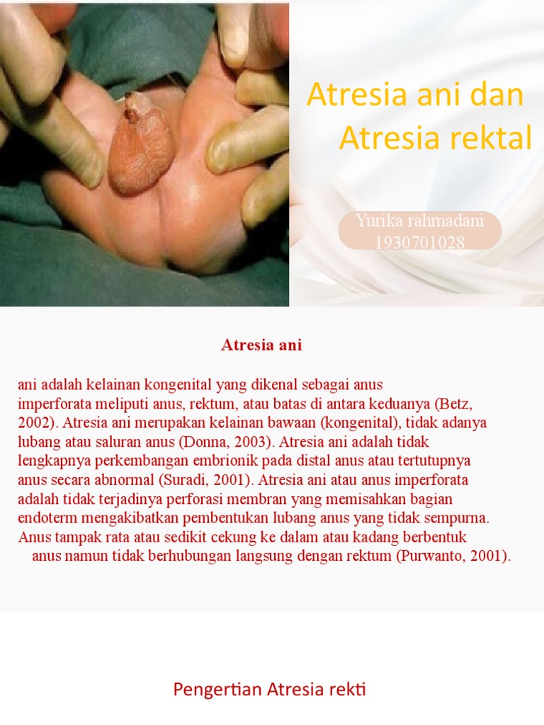 Anus atrofida tatuirovka bilan