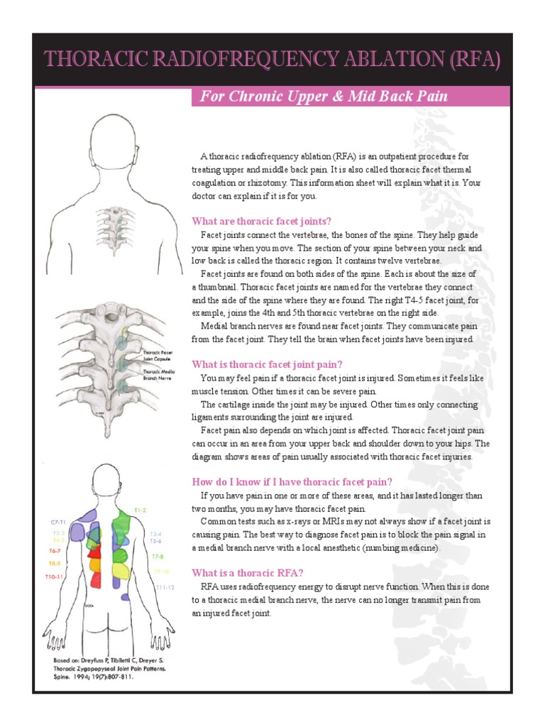 Thoracic Radiofrequency Ablation | PDF | Vertebral Column | Vertebra