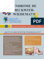 Síndrome Beckwhith Wiedemann