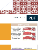 Vasculitis