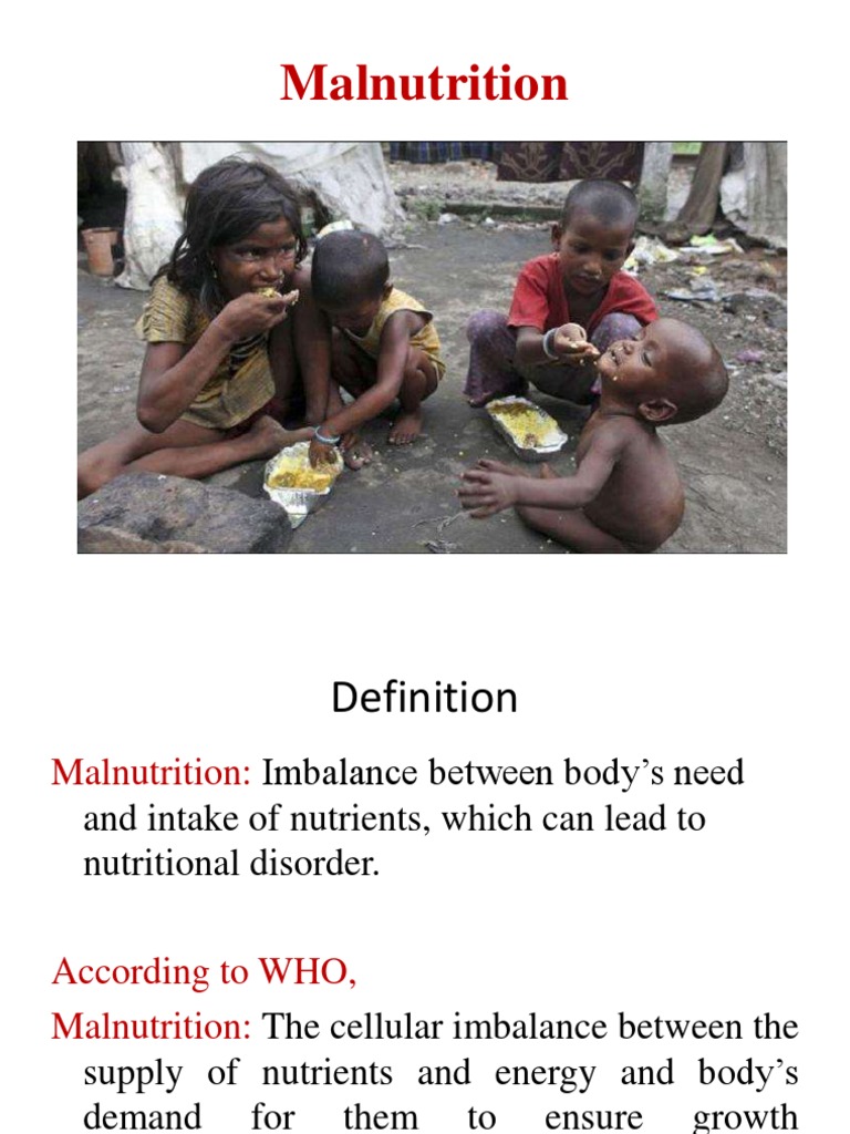 Understanding Malnutrition and Its Types | PDF | Wellness
