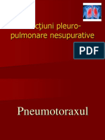 Afecţiuni_pleuro-pulmonare_nesupurative-15075