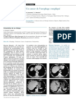 Cas Clinique +++KC Oesophage