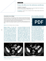 cas cancer colon mét hép+++.pdf