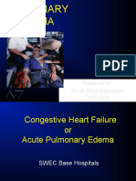 Pulmonary Edema: Prepared By: South West Education Committee