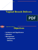 06 Breech Delivery.ppt