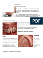 Inflamación oral causas