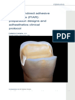 Posterior Indirect Adhesive Restorations (PIAR) : Preparation Designs and Adhesthetics Clinical Protocol