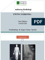 EWING SARKOMA Radiologi