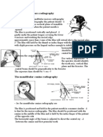 Mandibular Incisors Radiography