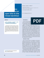 Paediatric Orthodontics Part 1: Anterior Open Bite in The Mixed Dentition