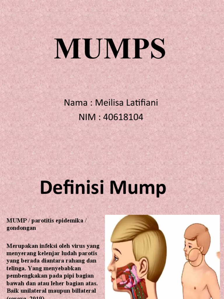 Perbedaan Mumps dan Parotitis | PDF | Kesehatan Holistik | Sains ...