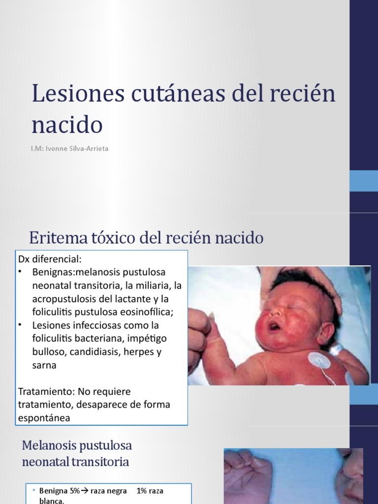 Lesiones cutáneas en recién nacidos | PDF | Enfermedades y trastornos