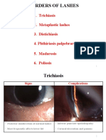 Disorders of Lashes: 1. Trichiasis 2. Metaplastic Lashes 3. Distichiasis 4. Phthiriasis Palpebrarum 5. Madarosis