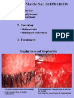 Chronic Marginal Blepharitis 1. Anterior: - Staphylococcal - Seborrhoeic